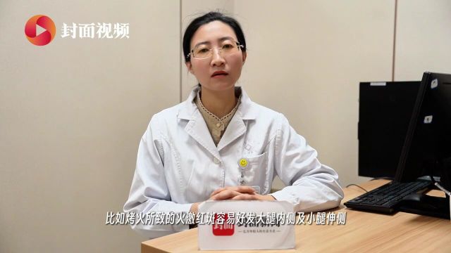 烤火患上“火激红斑”,冬季取暖需警惕