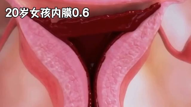 内膜6毫米正常吗?