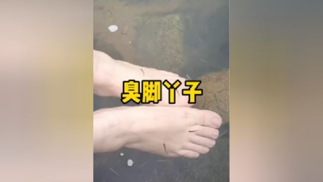 孩子脚臭怎么办?