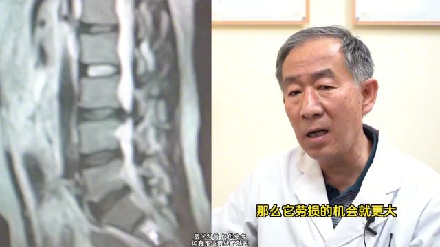 骨科蔡主任带你看腰椎核磁,高位椎间盘突出