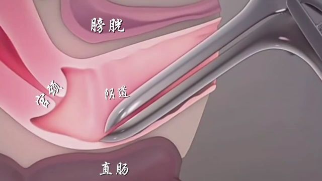 鸭嘴钳做了些啥?