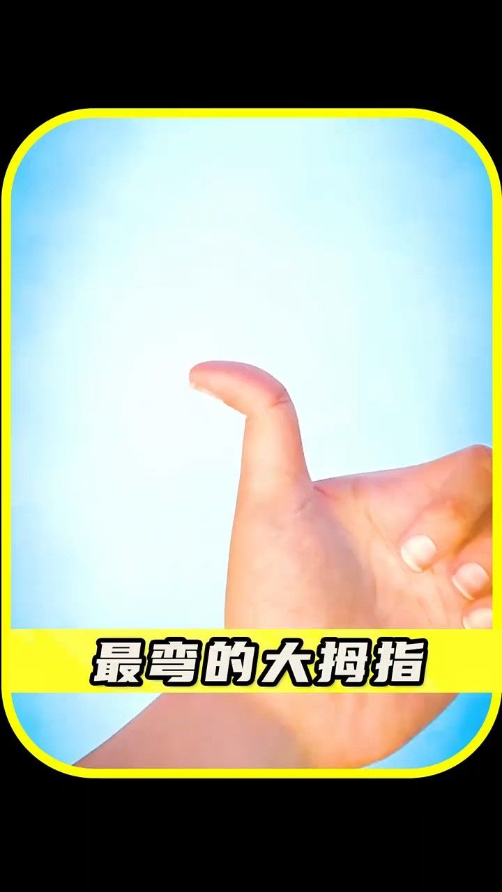 大拇指为啥可以这么弯?