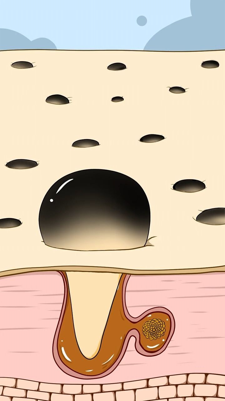 谁来拯救一下草莓鼻