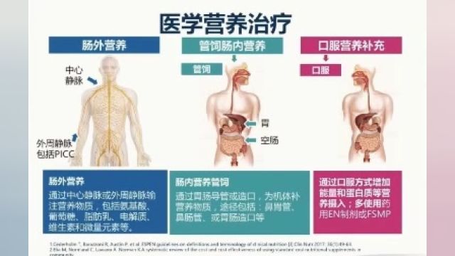 TNT医学营养治疗肠外营养和肠内营养干预