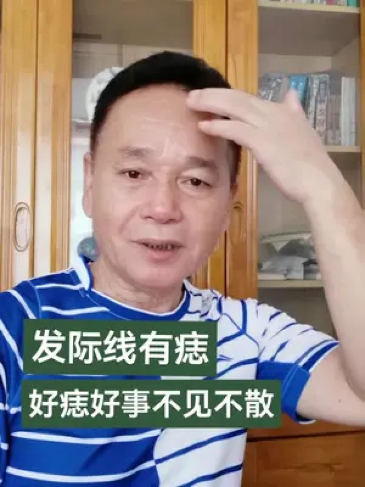 发际线有痣 #李永岳