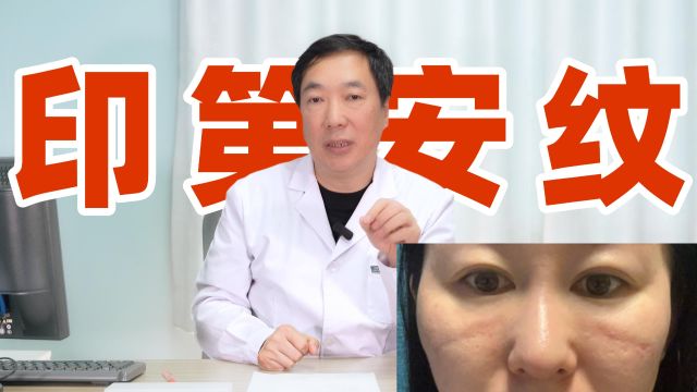 印第安纹填充,到底需不需要剥离?