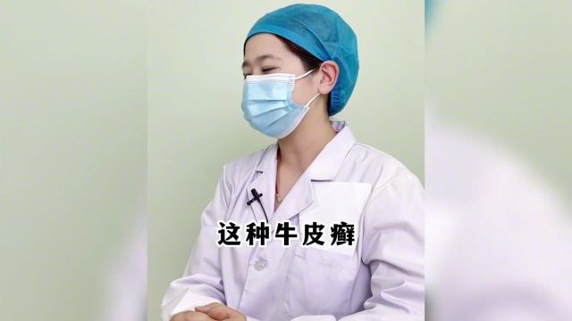 【科普】这2种类型的牛皮癣最简单,您是哪一种呢?