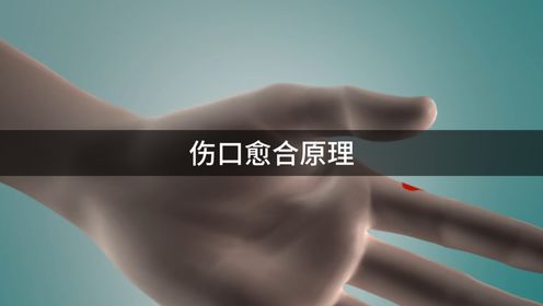 伤口是如何自愈的?带你看伤口愈合全过程,可不要乱扣伤疤_高清1080P在线观看平台_腾讯视频
