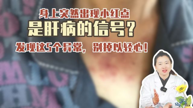 身上突然出现小红点,是肝病的信号?发现这5个异常,别掉以轻心!