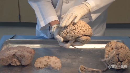 大脑解剖