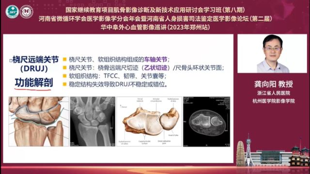 尺骨变异和桡尺远端关节不稳的影像学评价浙江省人民医院龚向阳