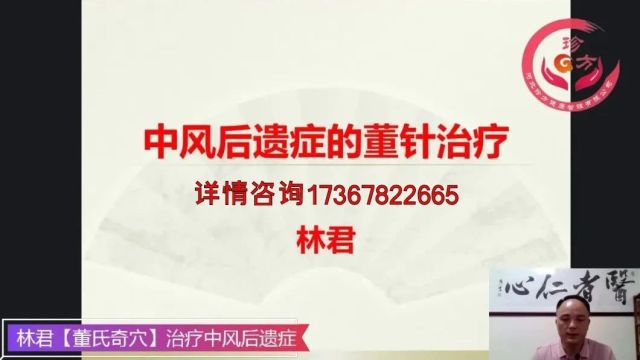 如何用针灸治疗中风后遗症?(分类、方法)