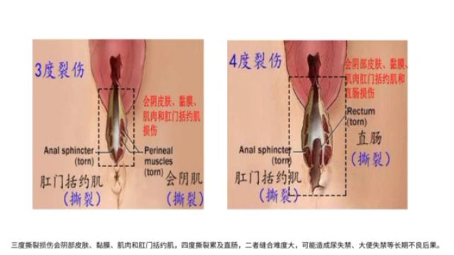 毕业论文