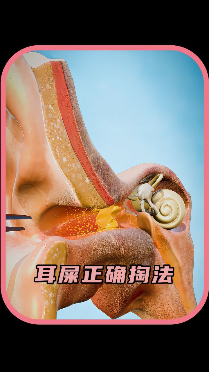 耳屎都是怎么形成的呢?