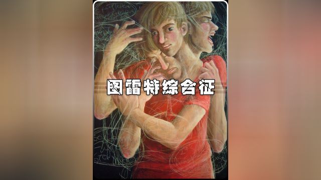 图雷特综合征