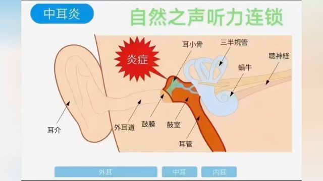 自然之声听力连锁