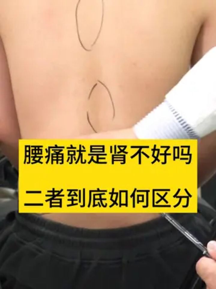 腰痛就是肾不好么,到底要如何区分 #腰痛 #肾病 #疼痛 #医学科普