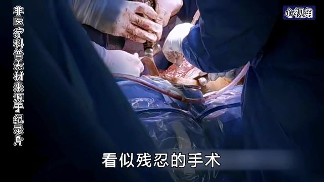 14岁的女孩不慎患上了骨癌,严重到要截肢,她宁愿选择安乐死!