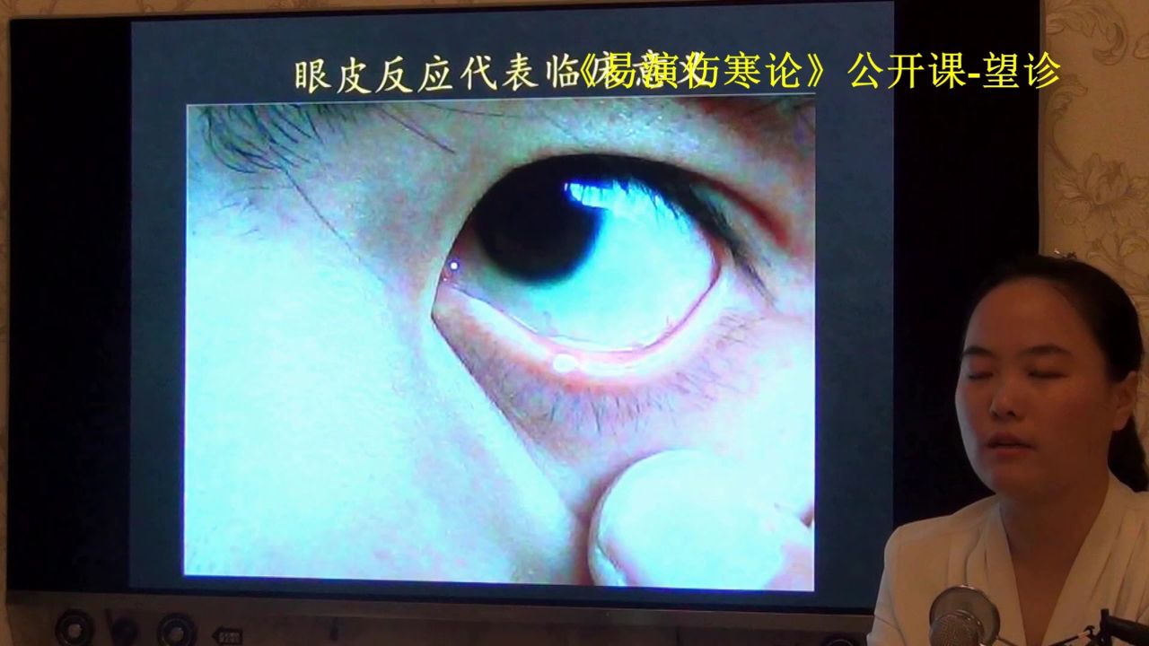 49望诊眼皮结膜苍白-易演伤寒论