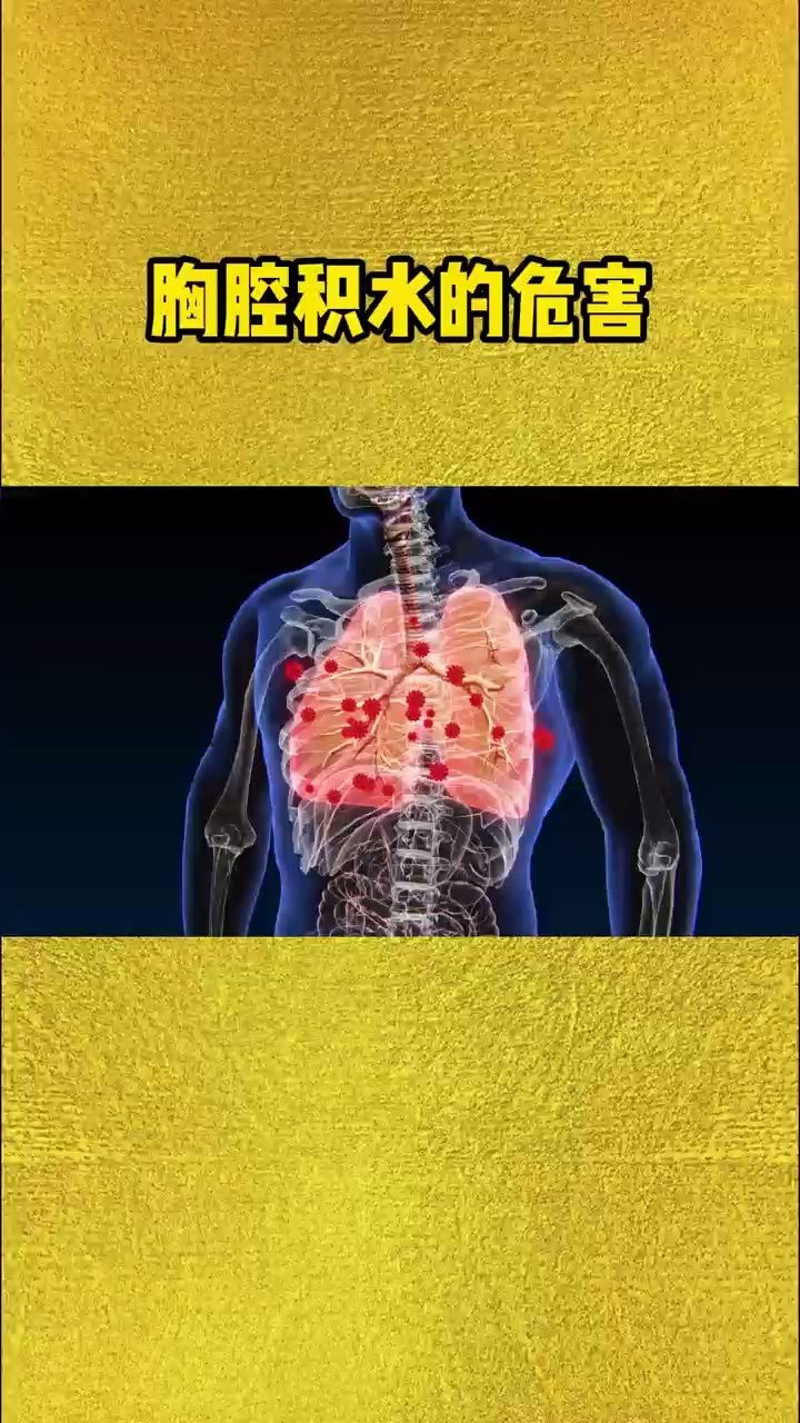 胸腔积液的危害