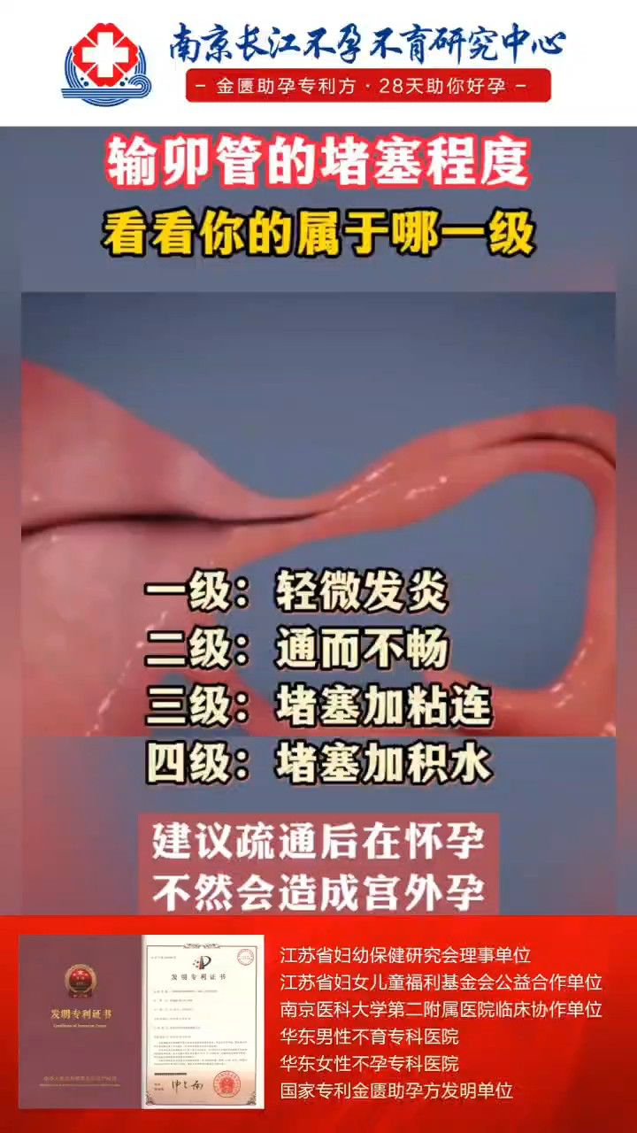 南京长江生殖医院:输卵管的堵塞程度,看看你属于哪一级