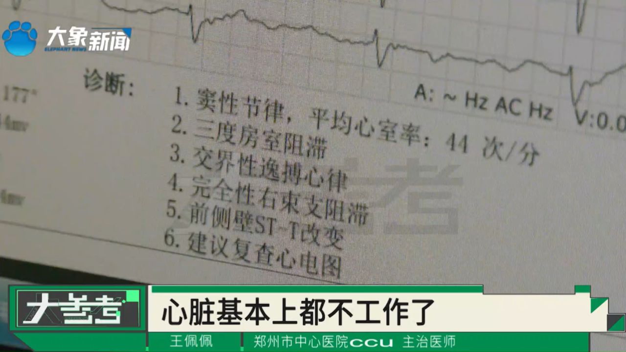 男子感冒发烧后晕厥?浑身无力,医生诊断竟是暴发性心肌炎!