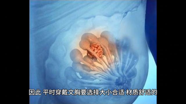 关于乳腺癌,这2个误区你要了解!