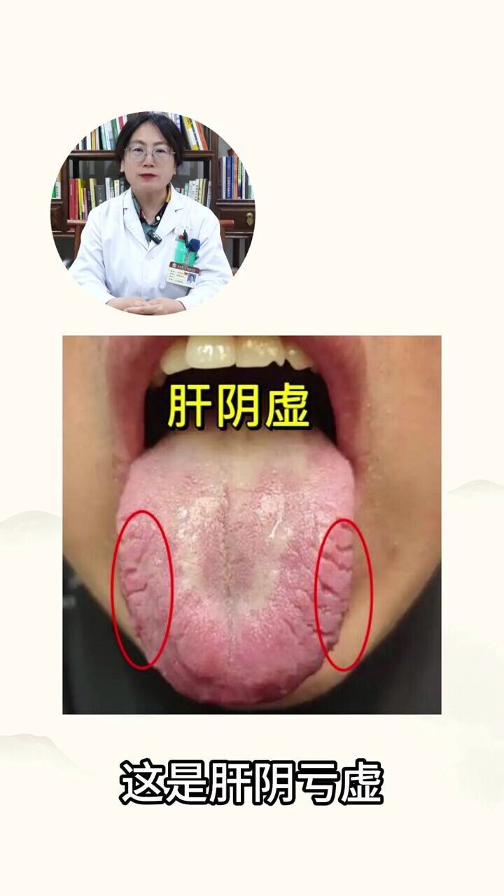 肝虚舌象大揭秘,五脏六腑的健康密码_高清1080P在线观看平台_腾讯视频