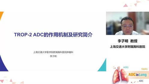 李子明教授：TROP2-ADC的作用机制及研究简介录制 下