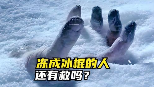 冻成冰棍的人，还有救吗？_高清1080P在线观看平台_腾讯视频