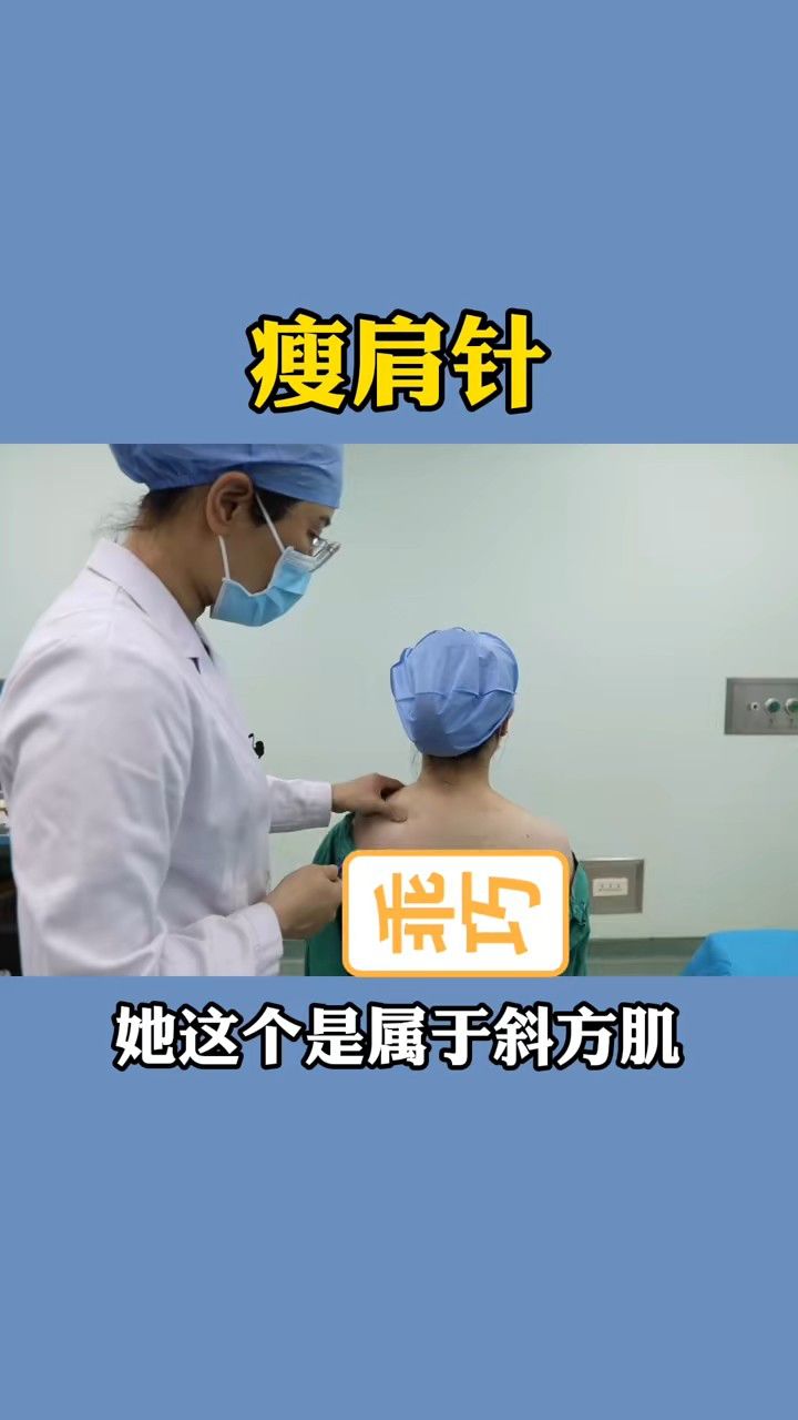 瘦肩针的注射部位图解图片