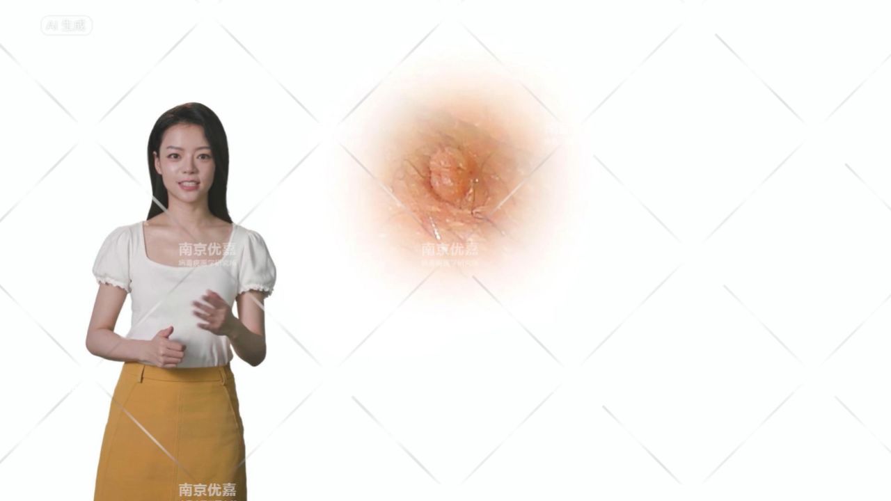 男性尖锐湿疣初期小丘疹图片-南京圣贝医院