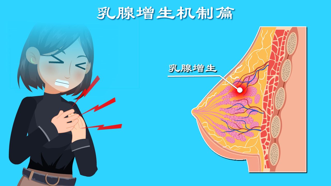 你的乳腺增生了吗?你知道你离乳腺癌只有两步吗?