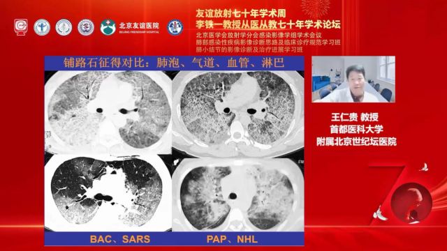 淋巴与间质性疾病首都医科大学附属北京世纪坛医院王仁贵