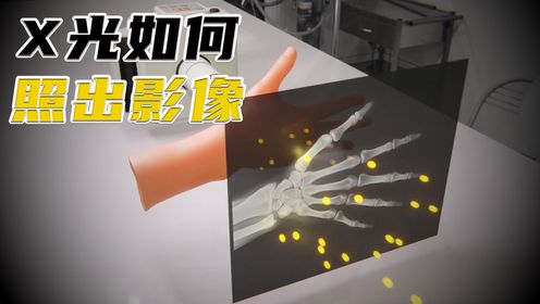 X光线是如何照出骨骼影像的?它跟CT又有什么区别?_高清1080P在线观看平台_腾讯视频