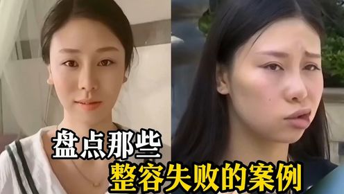 盘点那些整容失败的案例，身体发肤受之父母，要接受不完美的自己_综艺_高清完整版视频在线观看_腾讯视频