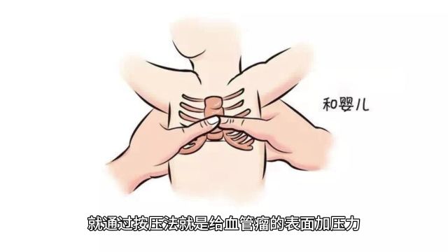 婴儿血管瘤怎么辨认