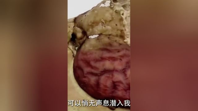 无孔不入的,是如何侵食的?要如何预防?