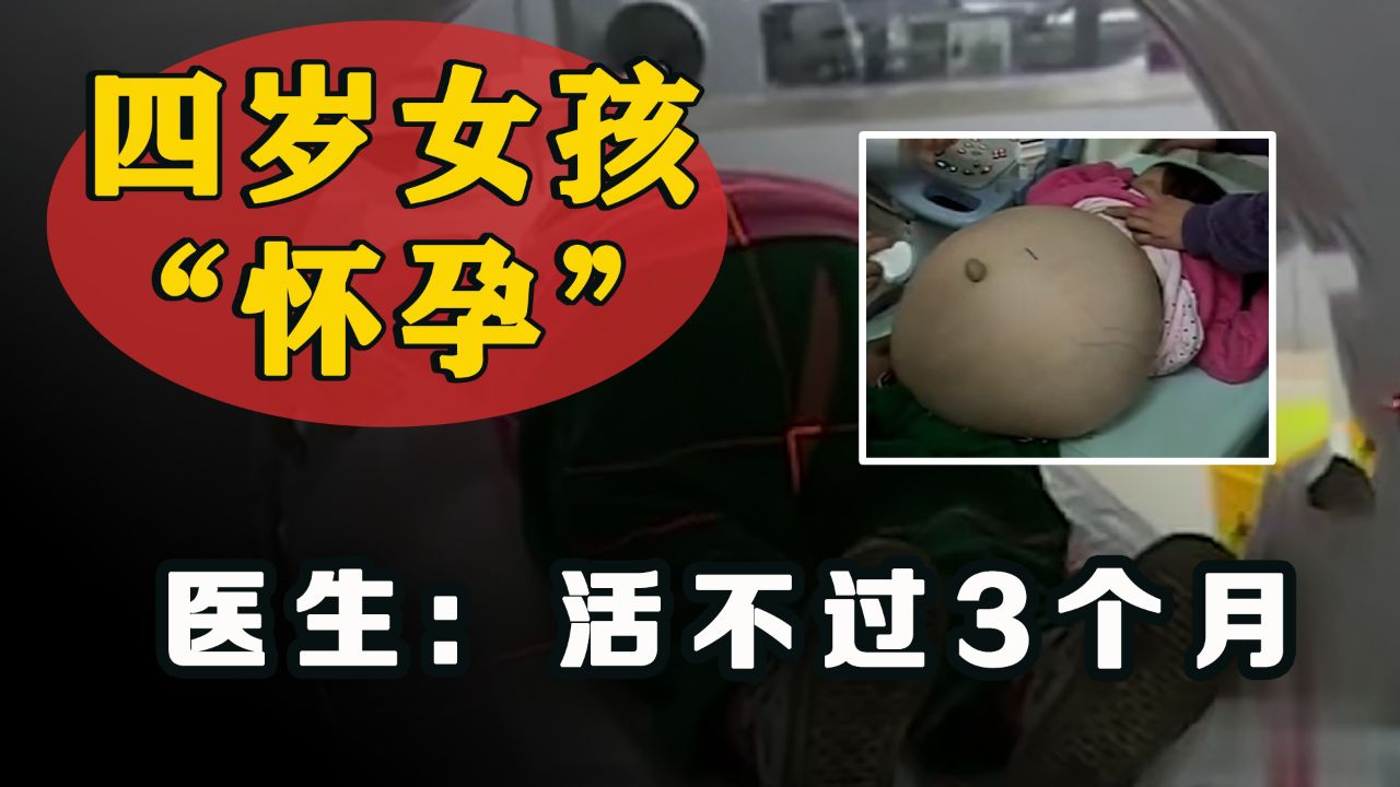 四岁女孩肚子大的像"怀孕",感觉快要爆炸,医生:活不过三个月