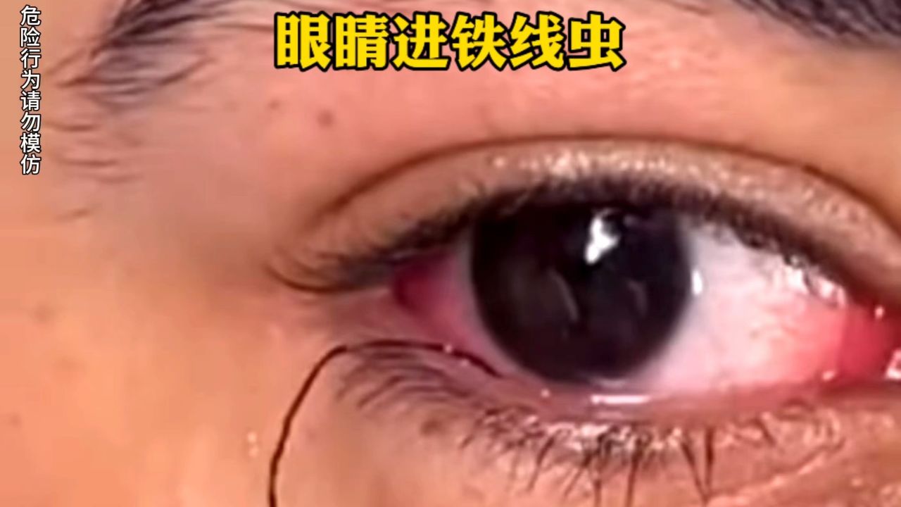 恐怖照片眼睛里的虫子图片