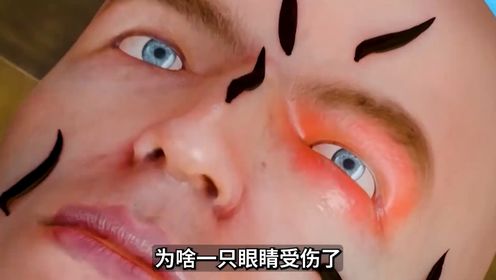 为啥一只眼睛受伤了,另一只也会瞎掉