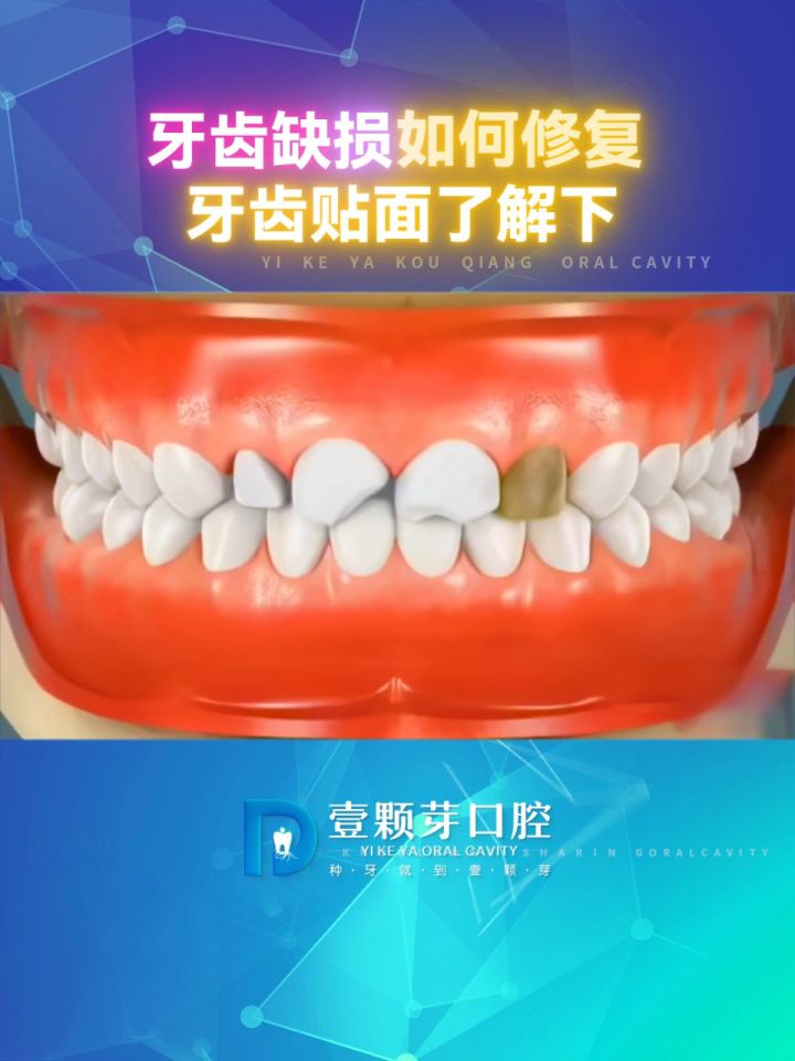 好牙依口腔连锁价目表图片