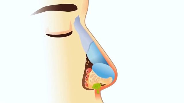挖鼻孔是对是错,吃鼻屎又有何风险? 3