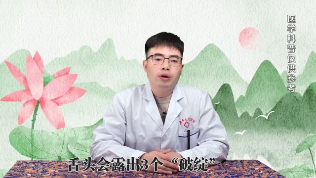 脾胃虚弱,舌头会露出3个“破绽”,别大意了.