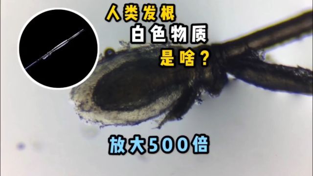 人类头发根部的乳白色物质是啥玩意?显微镜放大500倍告诉你!