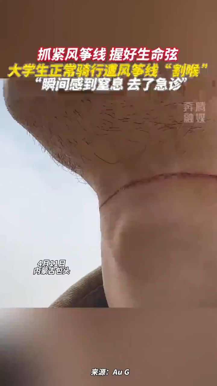 春季骑行 警惕"隐形"风筝线伤人