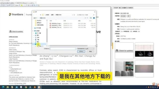 医学文献王PDF阅读器:医生的智能阅读新选择!