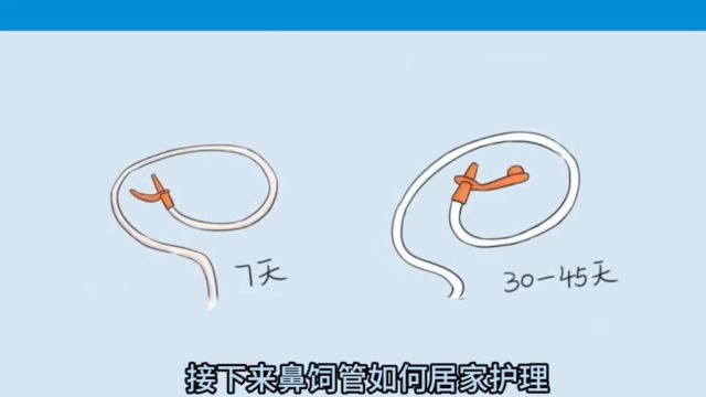 鼻饲管的家庭护理