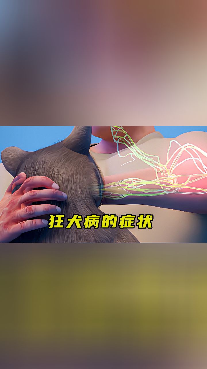 狂犬病照片 症状图片