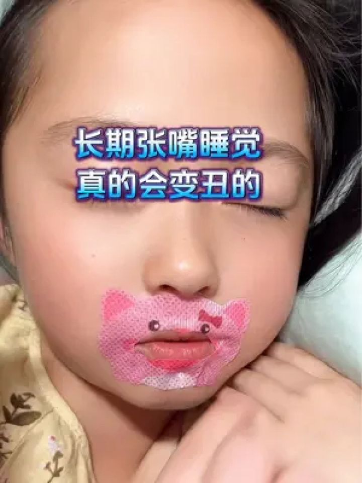 长期张嘴睡觉会变丑 女儿因长龅牙就习惯性的张着嘴睡觉,幸好发现了